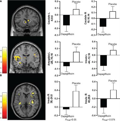 Frontiers Brain Activation In Response To Low Calorie Food Pictures